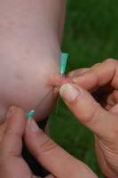 Outdoor Needle Pain