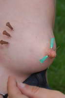 Outdoor Needle Pain