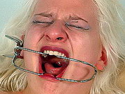 Dental Gagged Electro Pain