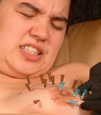 Asian Electro Needles
