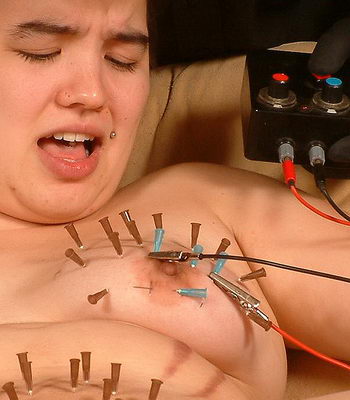Electro Needles