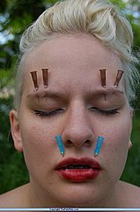 Facial Needle Pain