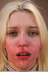 Nose Torment and Humiliation