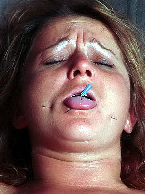 Facial Needle Pain