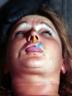 Facial Needle Pain
