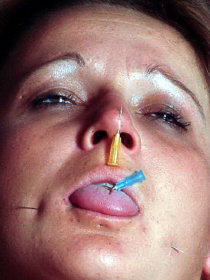 Facial Needle Pain
