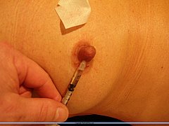 Amateur Needle Pain