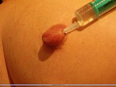 Amateur Needle Pain