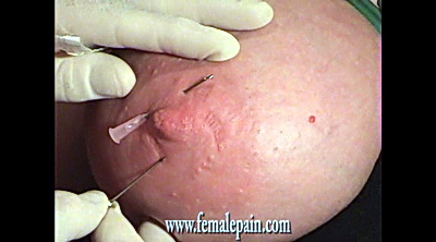 Amateur Needle Pain