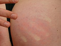 Painful Spanking