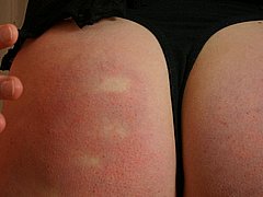 Painful Spanking