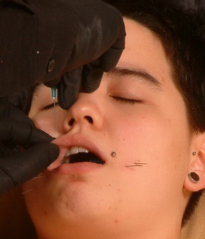 Needles in Face