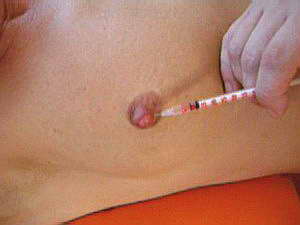 Needle Pain