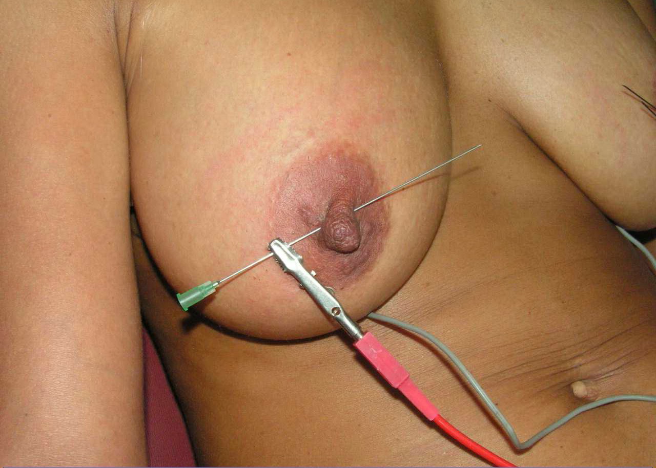 Self with long needles 91 sec Kinkycore - Impressive saline breast growth. 